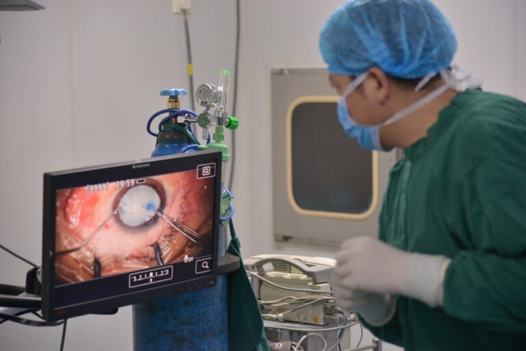 Cataract surgery